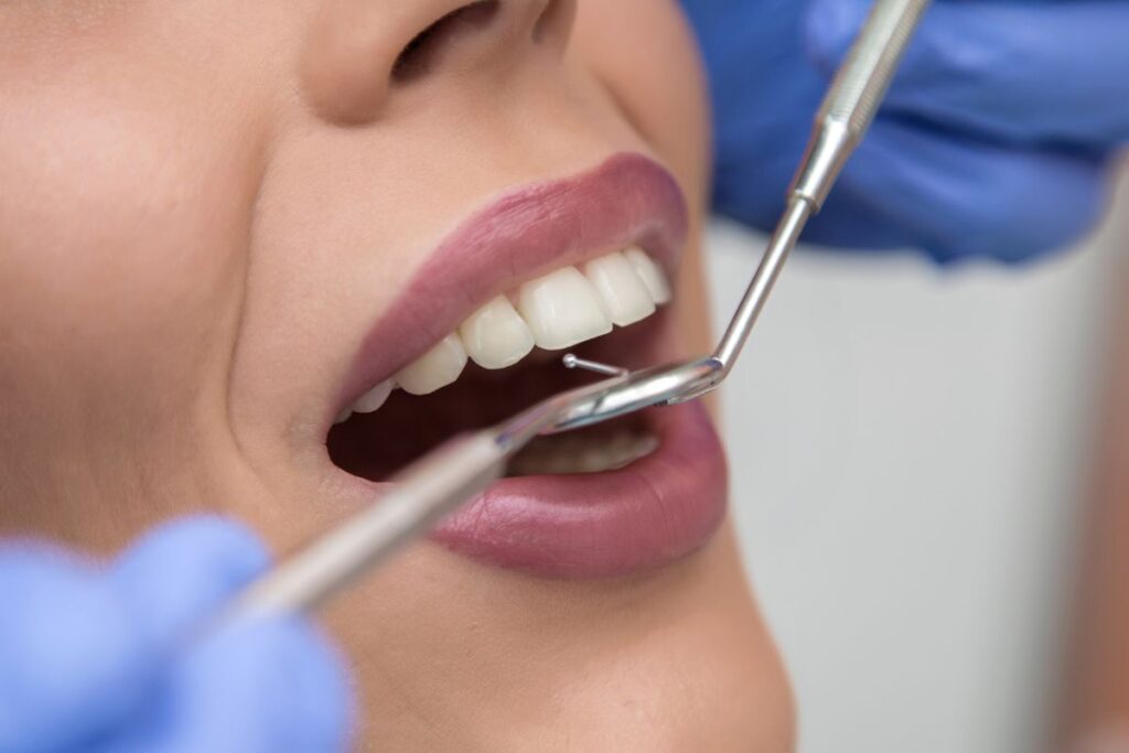 Últimos avances en estética dental