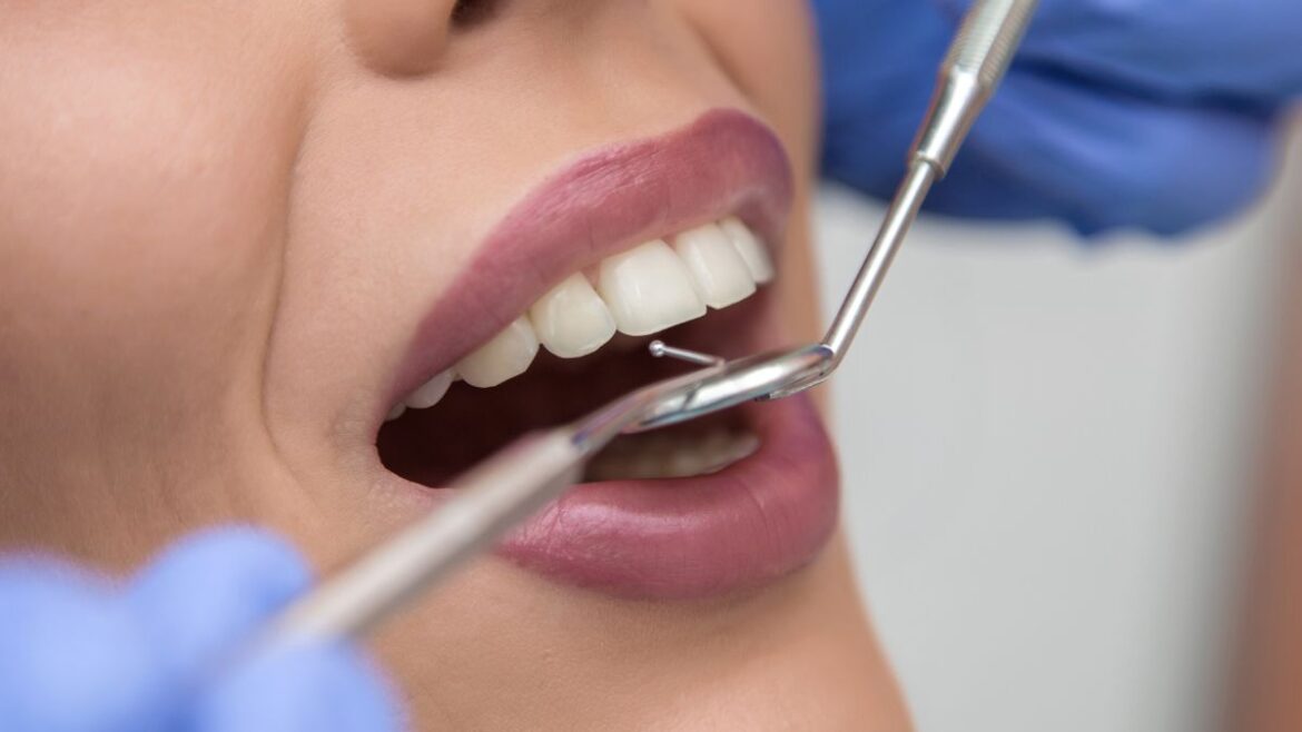 Últimos avances en estética dental