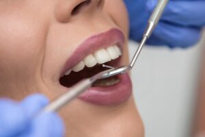 Últimos avances en estética dental