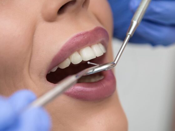 Últimos avances en estética dental