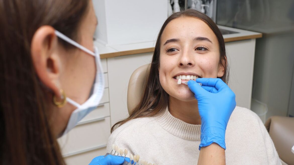 Toma de color para ponerse carillas dentales