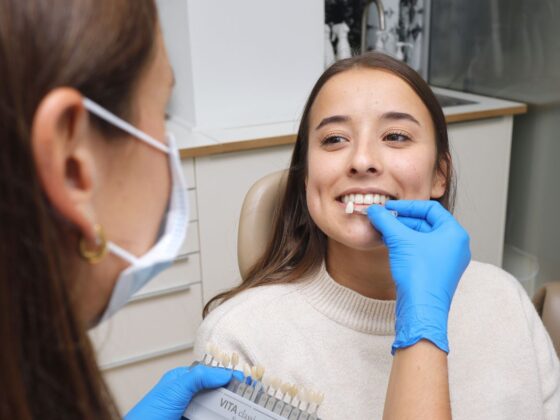 Toma de color para ponerse carillas dentales