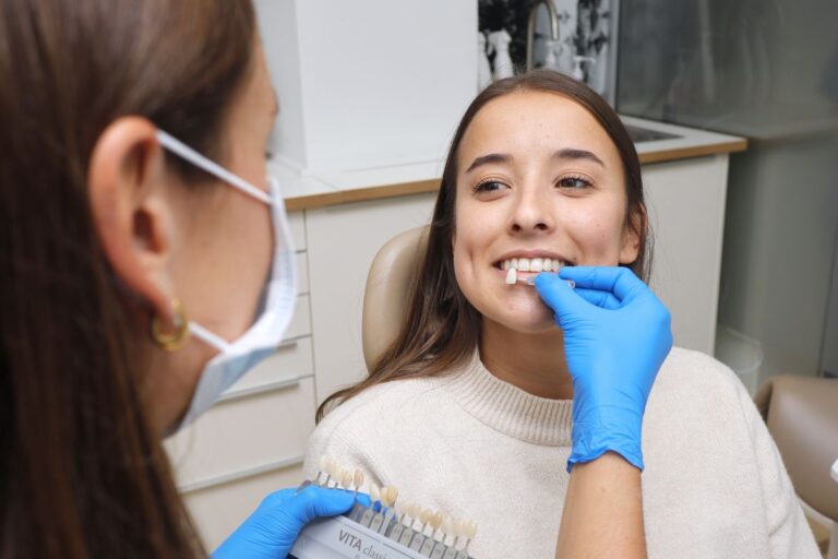 Toma de color para ponerse carillas dentales